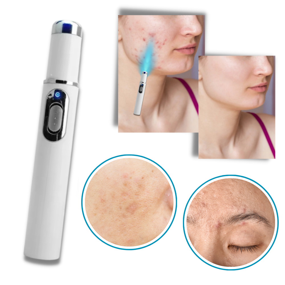 DermaPure | Thérapie laser portable pour un teint plus lumineux